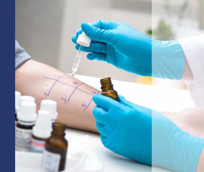 Provokationstest auf Allergien am Unteram.