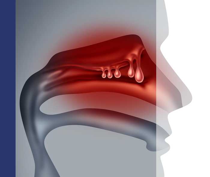 Schematische Grafik des Aufbaus der Nase