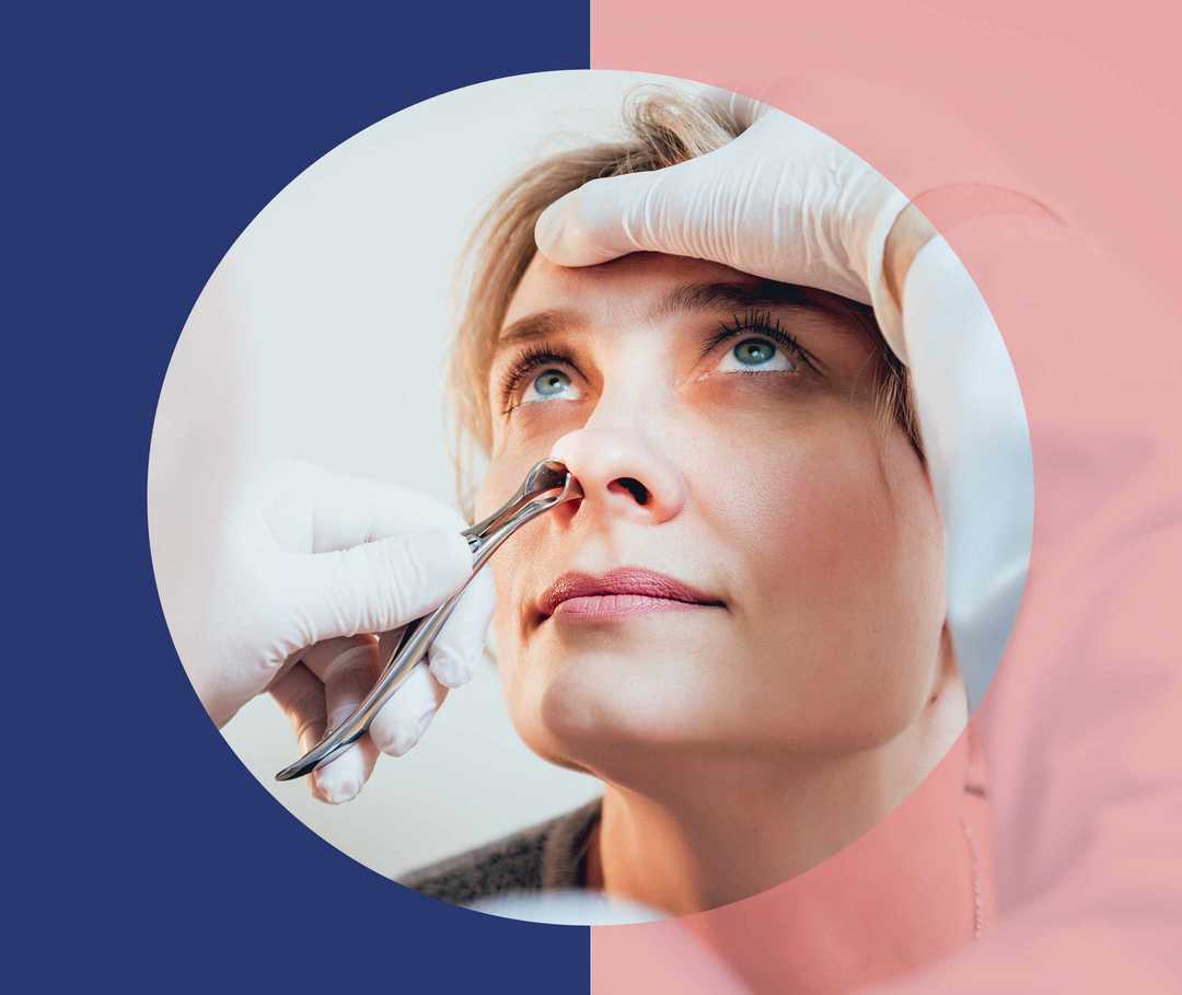 Untersuchung der Nasenhöhle bei einer Frau